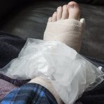 InjuredAnkle2 InjuredAnkle2